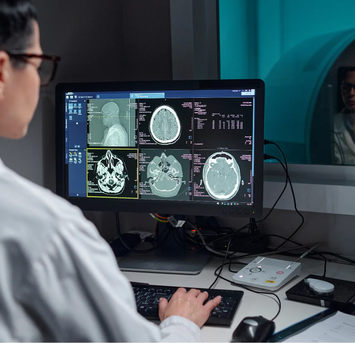 A doctor examines brain scans on a computer monitor in a medical imaging room.