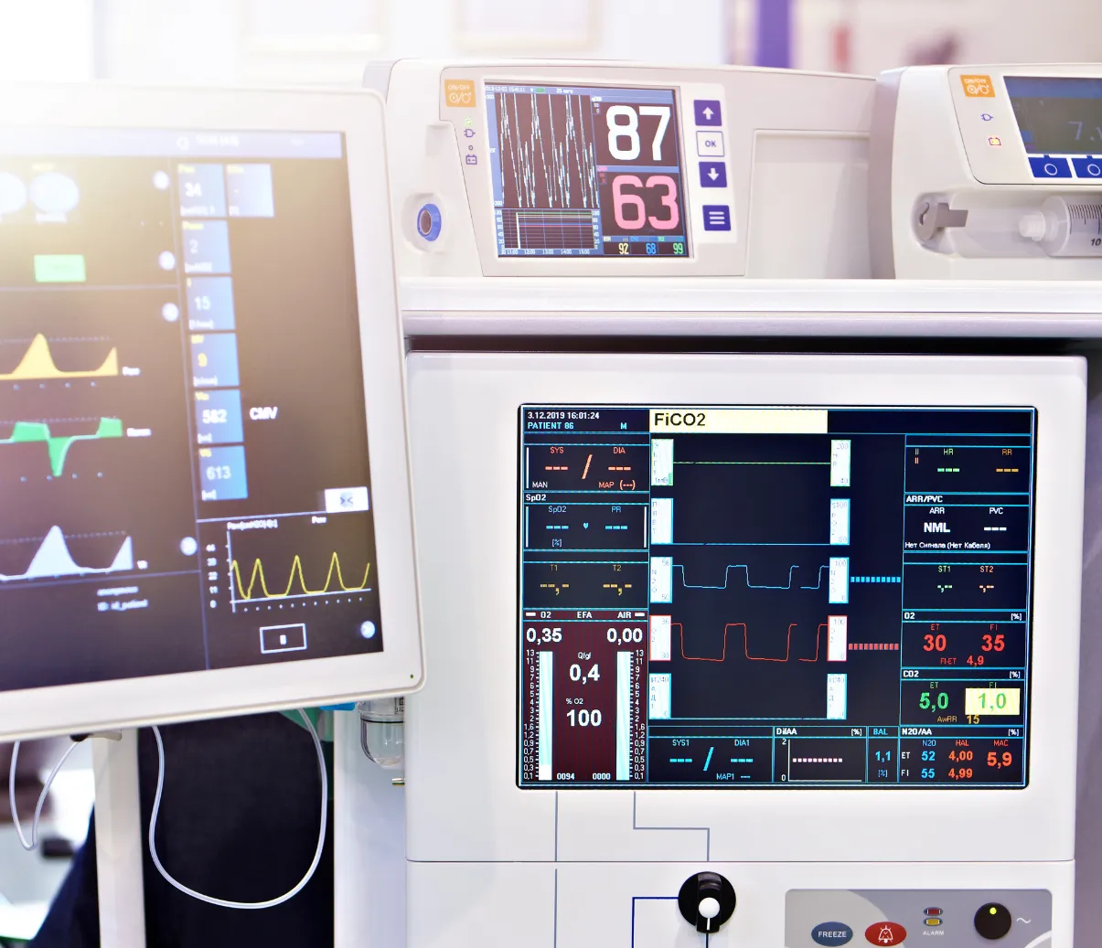 Close-up of hospital monitors displaying vital signs, heart rate, and respiratory patterns in a medical setting.